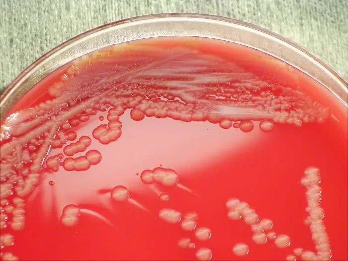 A close-up photograph of a blood-agar petri dish, dark pink-red in colour, streaked with pale cream bacterial colonies of varying size.